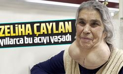 Zeliha Çaylan'ın, Yıllarca Süren Doktor Korkusu, 2 Kilogramlık Guatrın Ameliyatla Çıkarılmasıyla Son Buldu