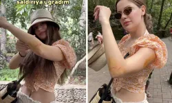 Turist Kadının Bali Macerası, Meraklı Maymun Saldırısıyla Noktalandı