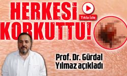 Karadeniz'in Korkulu Rüyası O Böcek Herkesi Korkuttu; Prof. Dr. Açıkladı!