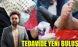 Sinek Larvalarıyla Yara Tedavisi: Amputasyona Alternatif Bir Yöntem