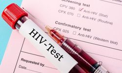 HIV/AIDS Hakkında Bilinmeyenler: Türkiye’de Vaka Sayısı Artıyor!