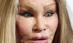 Kedi Kadın Jocelyn Wildenstein Hayatını Kaybetti: Estetik Tutkusu ve Fırtınalı Yaşamı