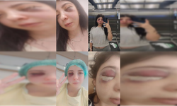 Damla’yı sokak ortasında darbeden sanık, tahliye edildi