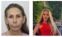 Ünlü Şarkıcının Annesine Karadeniz'de Estetik Ameliyatı