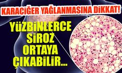 Karaciğer Yağlanmasına Dikkat! 400 Bin Siroz Vakası Bekleniyor