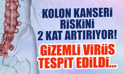 Kolon Kanseri Riskini 2 Kat Artırıyor! Gizemli Virüs Tespit Edildi...