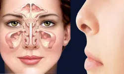 Burun tıkanıklığının sebebi Konka büyümesi olabilir