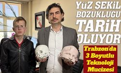 Trabzon’da 3 Boyutlu Teknoloji Mucizesi: Yüz Deformasyonu Düzeltildi