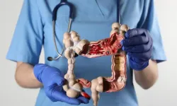 'Kolon kanserinde erkeklerde risk daha fazla'