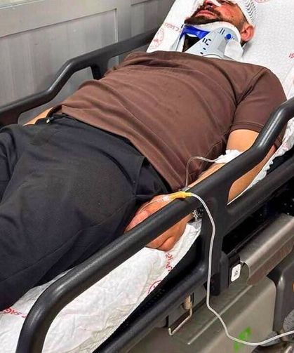 Rize’de Otomobil İle Çöp Kamyonu Kafa Kafaya Çarpıştı: 2 Yaralı