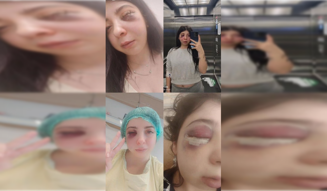 Damla’yı sokak ortasında darbeden sanık, tahliye edildi