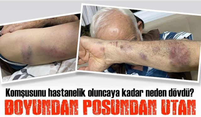 Trabzon’da 83 Yaşındaki Vatandaşa Polis Memurundan Şok Saldırı İddiası