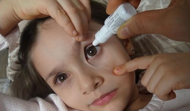 Çocuklarda Göz Damlası Nasıl Damlatılmalı? Uzmandan Altın Tavsiyeler