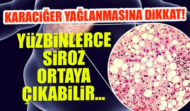 Karaciğer Yağlanmasına Dikkat! 400 Bin Siroz Vakası Bekleniyor