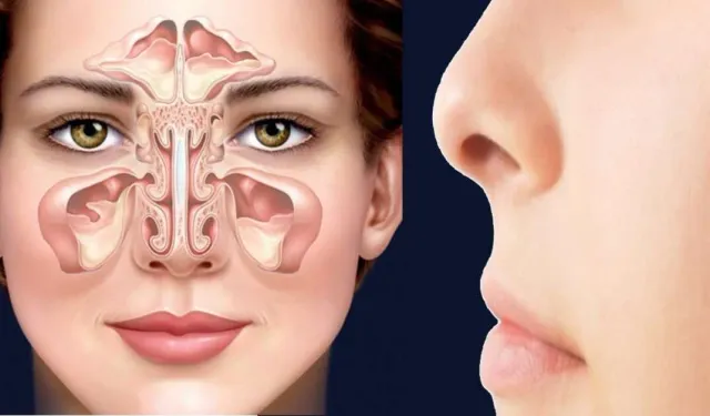 Burun tıkanıklığının sebebi Konka büyümesi olabilir