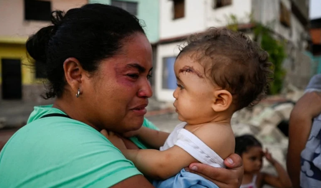 Venezuela Depreminde Can Kaybı Artıyor: Yaralı Sayısı 4 Bin 300’e Yükseldi