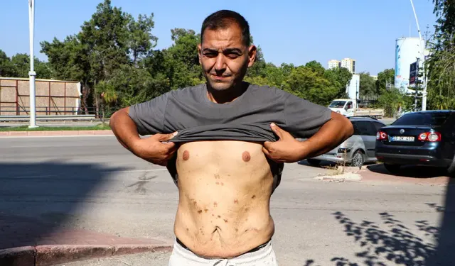 Zayıflamak için ameliyat oldu: 157 kilodan 72 kiloya düştü