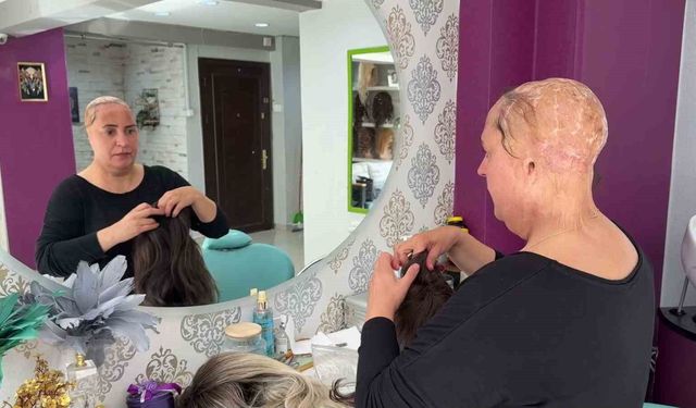 12 yaşında saçlarını ve kulaklarını kaybetti, şimdi kadınlara umut oluyor