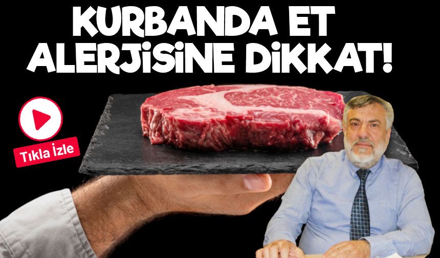 Kurban Bayramı’nda Et Alerjisine Dikkat! Uzmandan Alpha-gal Uyarısı