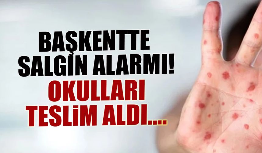 Londra’da Korkutan Tablo: Kızamık Salgını Okulları Teslim Aldı!