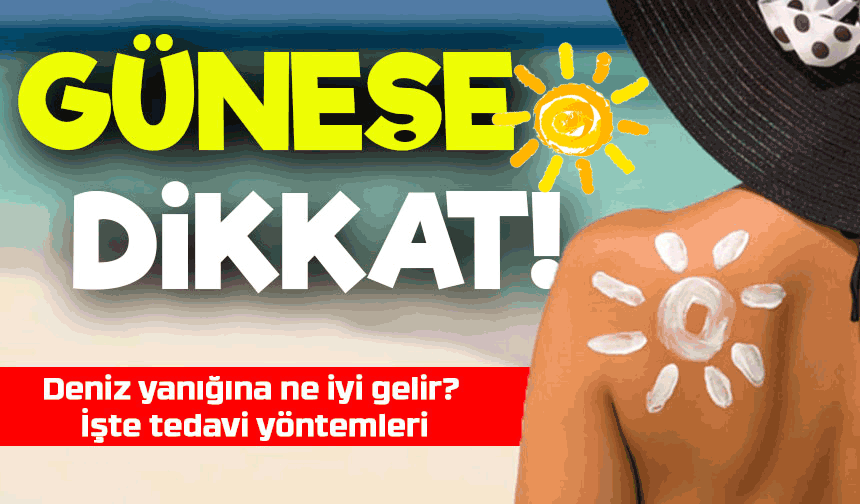 Deniz yanığına ne iyi gelir? Belirtileri ve tedavi yöntemleri neleri?